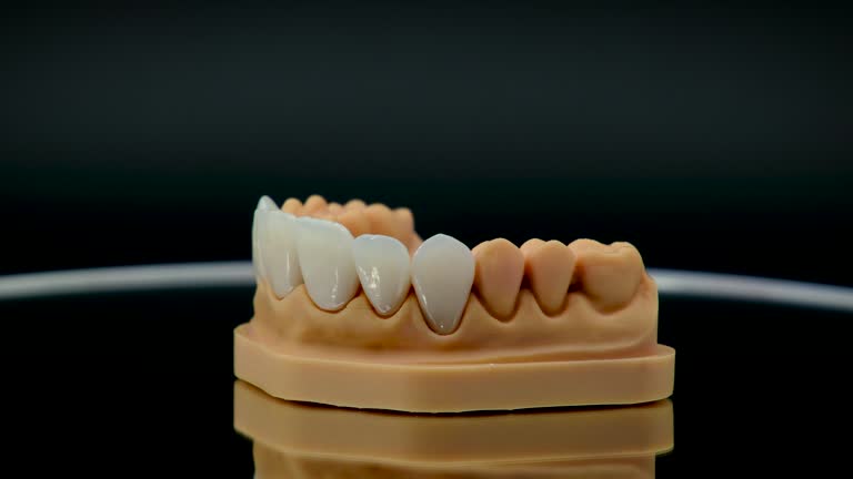 Best Dental Implants  in USA